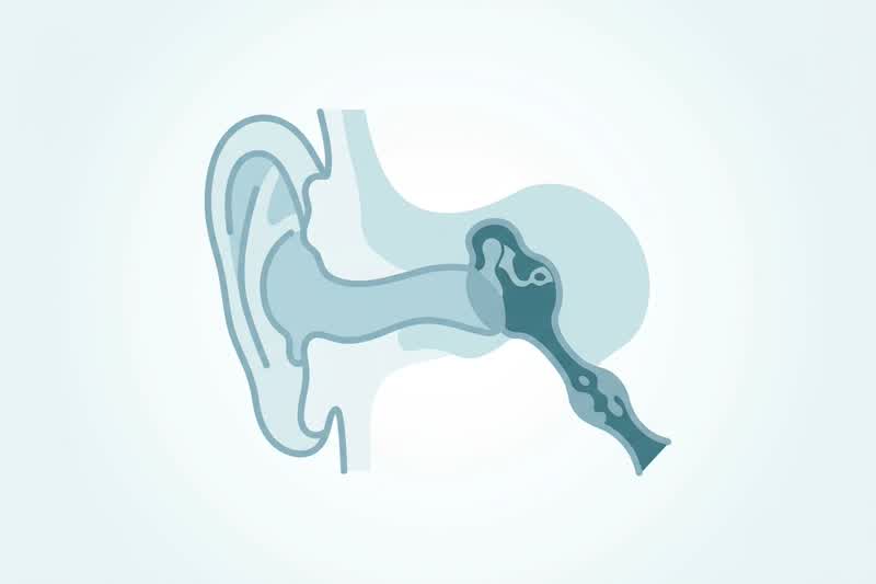 How to unclog ears - medical illustration